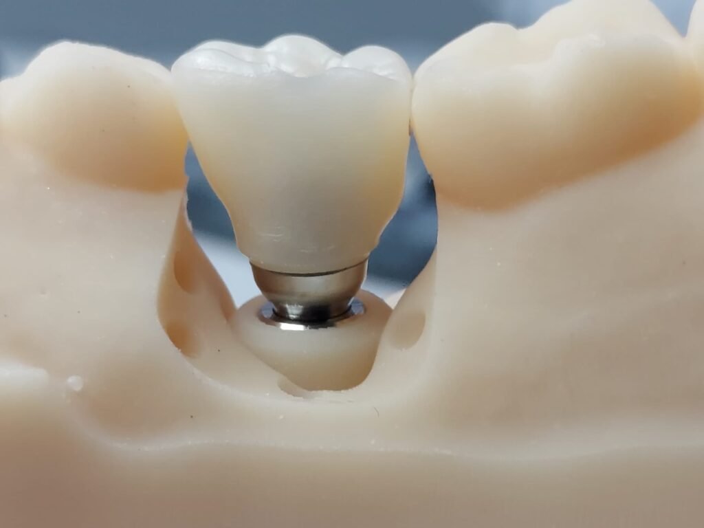 Protesis dental